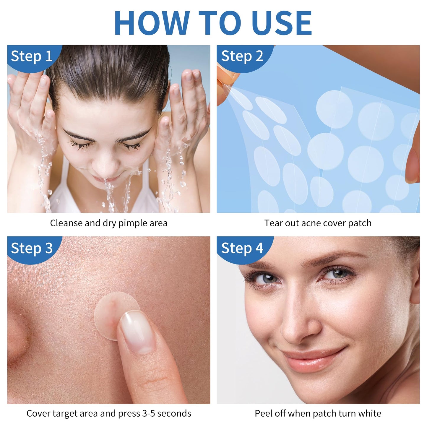 Pimple Patches for Face, 4 Size 300 Counts Acne Patches, Hydrocolloid Patches for Covering Zits and Blemishes, Spot Stickers for Face and Skin