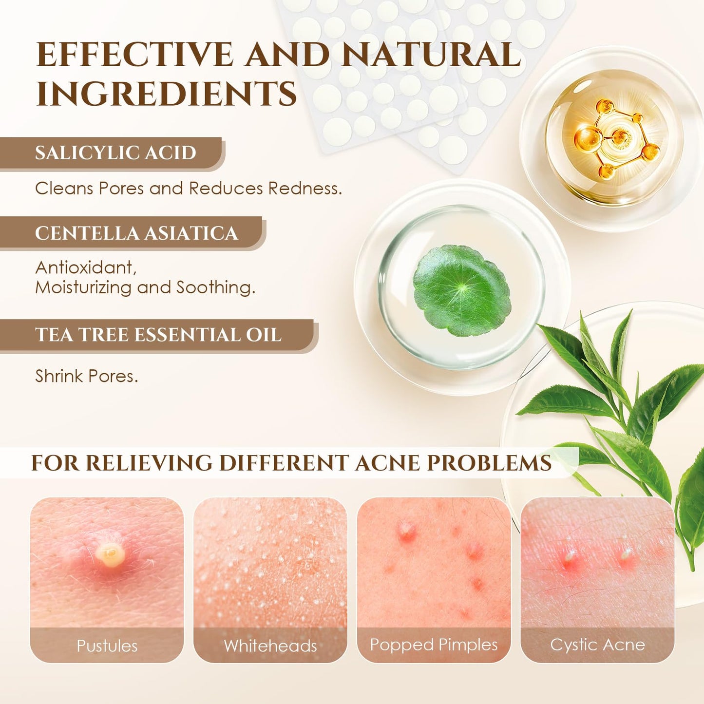Pimple Patches for Face, 4 Size 300 Counts Acne Patches, Hydrocolloid Patches for Covering Zits and Blemishes, Spot Stickers for Face and Skin