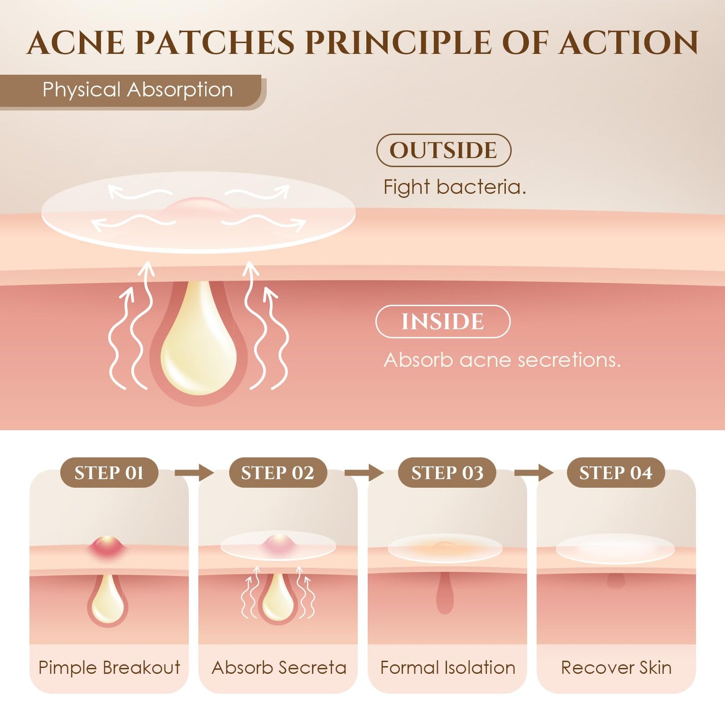 Pimple Patches for Face, 4 Size 300 Counts Acne Patches, Hydrocolloid Patches for Covering Zits and Blemishes, Spot Stickers for Face and Skin