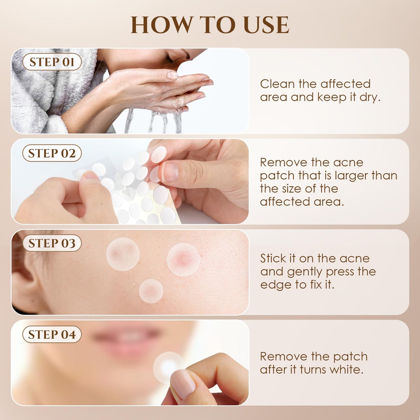 Pimple Patches for Face, 4 Size 300 Counts Acne Patches, Hydrocolloid Patches for Covering Zits and Blemishes, Spot Stickers for Face and Skin