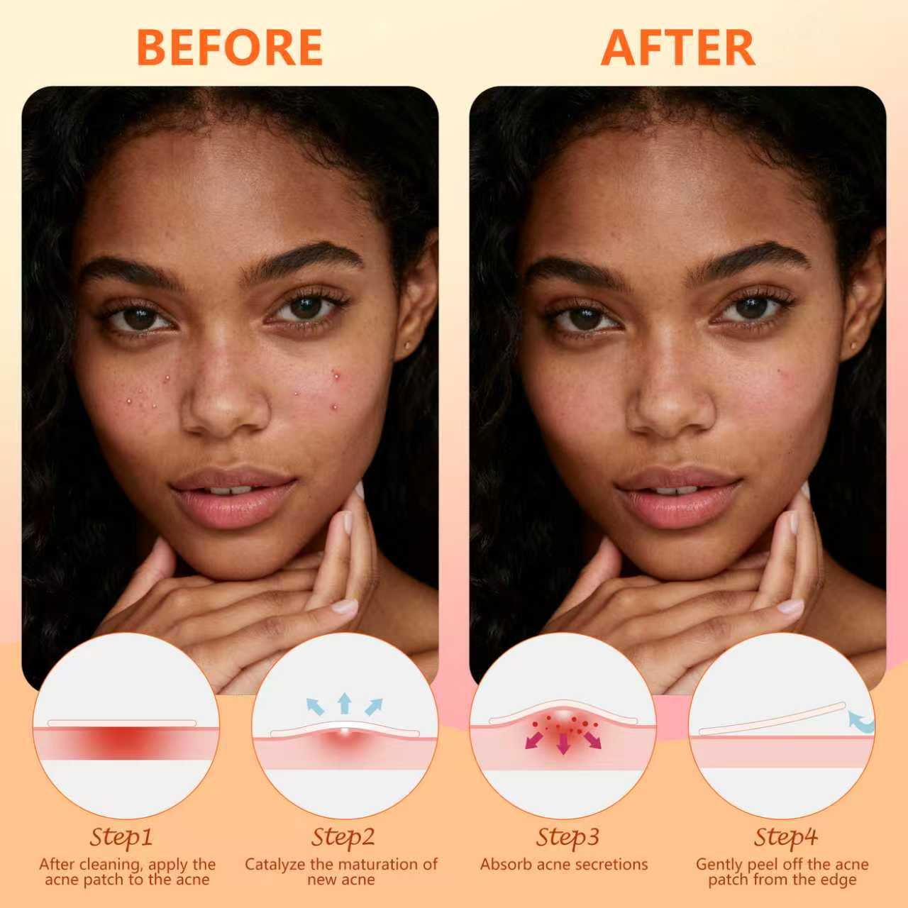 Pimple Patches for Face, 225 Counts Hydrocolloid Acne Patches, Star Heart Shape Zit Covers, Colorful Superstar Spot Acne Pimple Patches Stickers