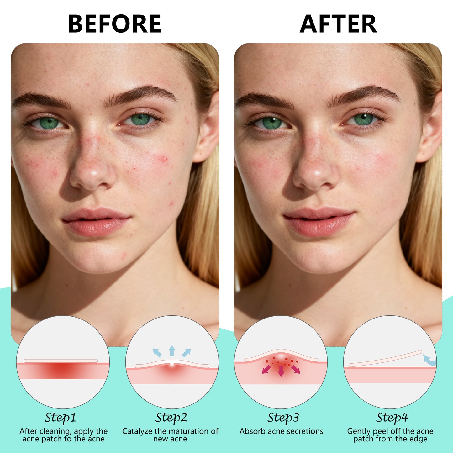 Pimple Patches for Face, Hydrocolloid Acne Patches, Star Zit Covers, Superstar Patches Spot Stickers, 102 Count | 4 Sizes (8mm/9mm/11mm/14mm)