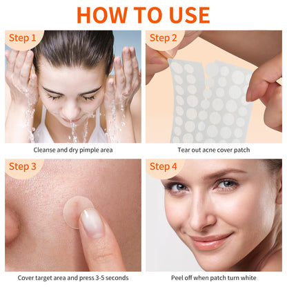 Pimple Patches for Face, 3 Size 102 Counts Acne Patches, Hydrocolloid Patches for Covering Zits and Blemishes, Spot Stickers for Face and Skin