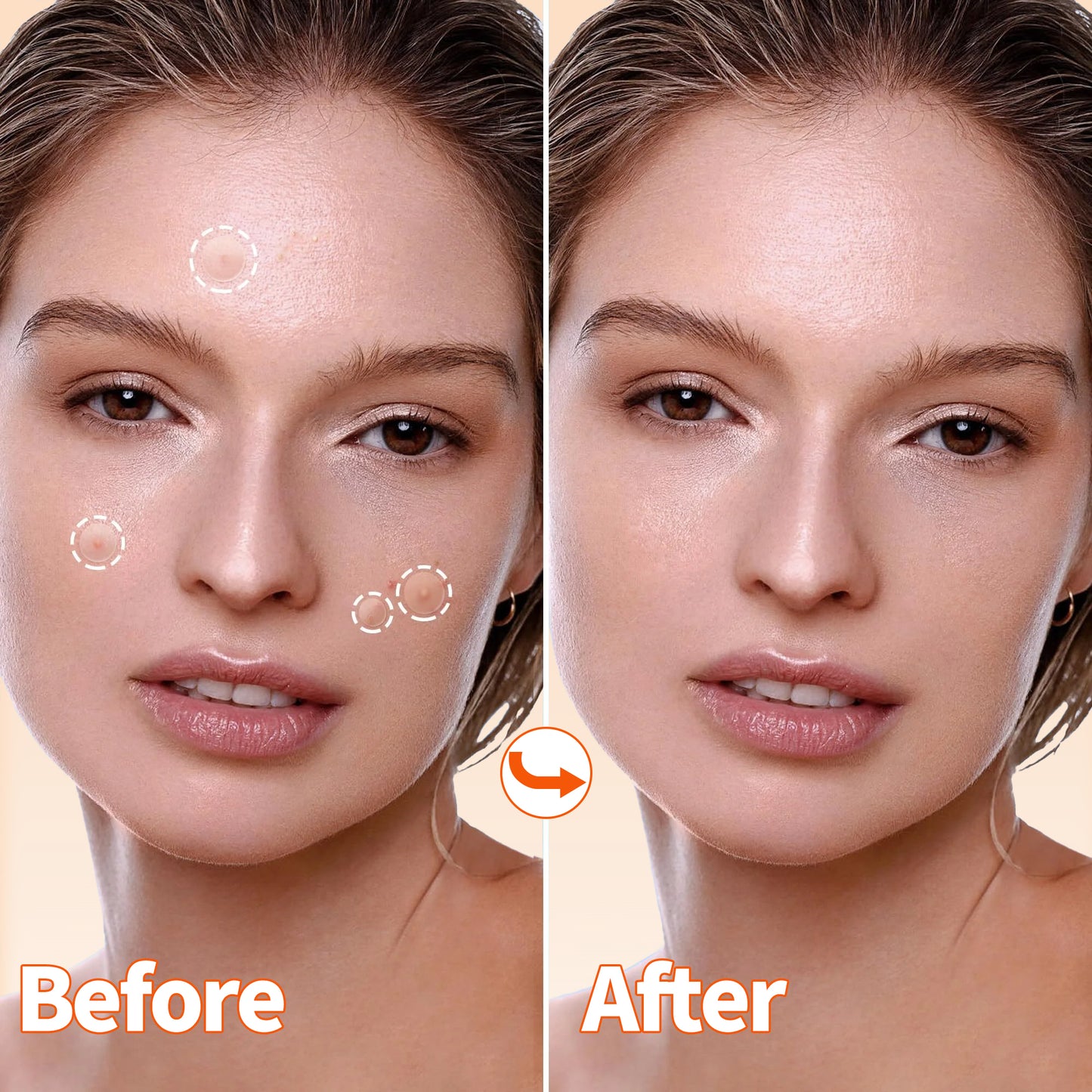 Pimple Patches for Face, 3 Size 102 Counts Acne Patches, Hydrocolloid Patches for Covering Zits and Blemishes, Spot Stickers for Face and Skin