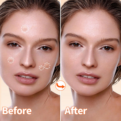 Pimple Patches for Face, 3 Size 102 Counts Acne Patches, Hydrocolloid Patches for Covering Zits and Blemishes, Spot Stickers for Face and Skin